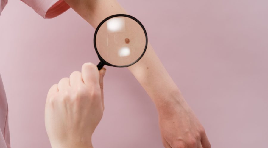 Avoir un rdv chez un dermatologue rapidement